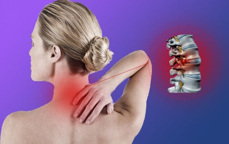 Inflammation of the spine with osteochondrosis of the cervical