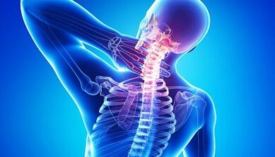 Complications of osteochondrosis of the cervical back