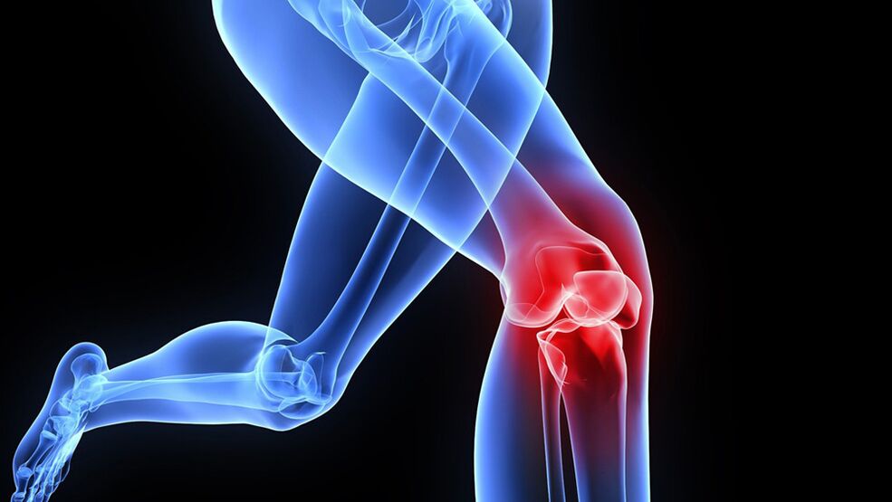 knee problems due to arthrosis